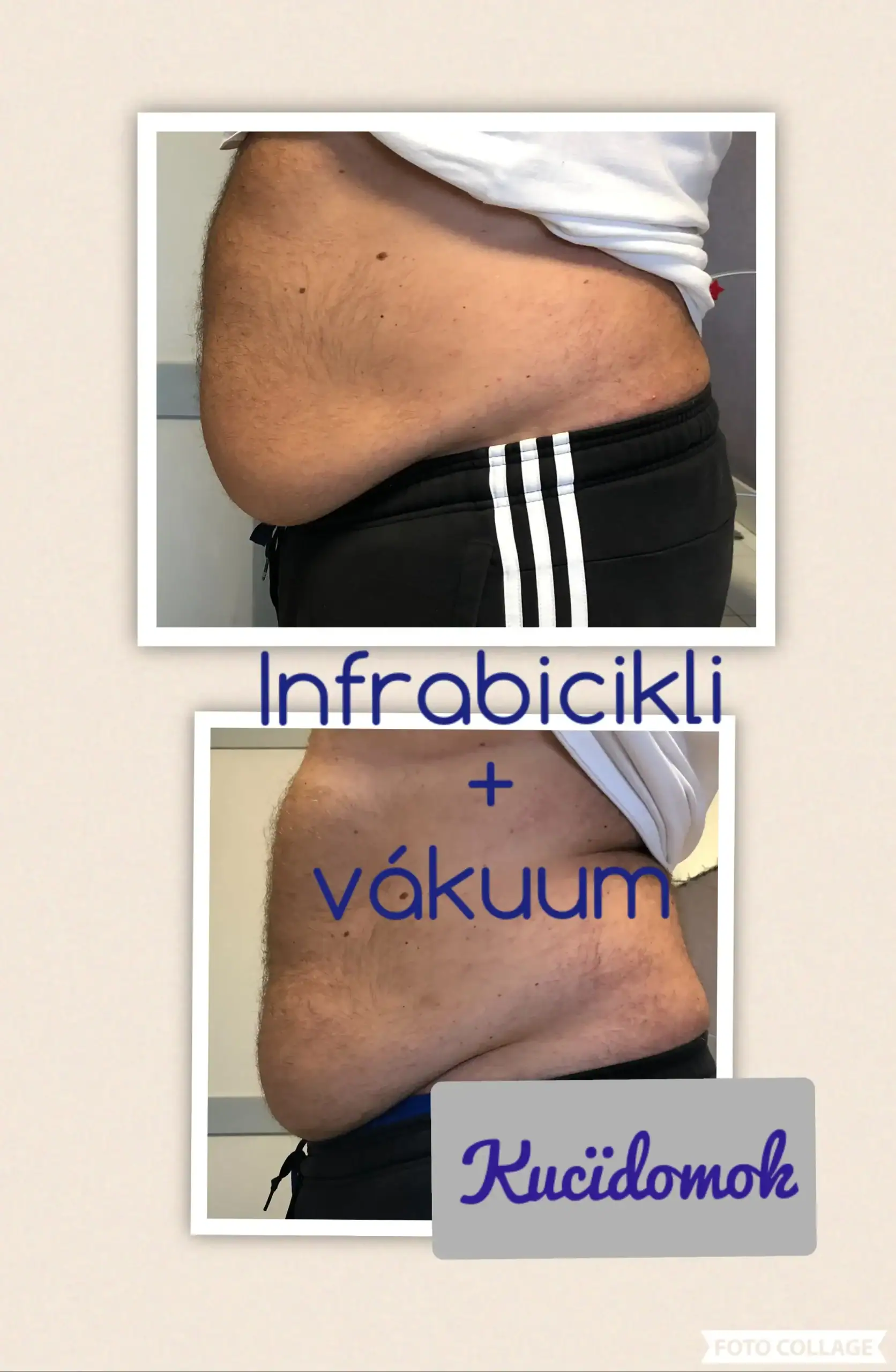 infrabicikli és vákuum